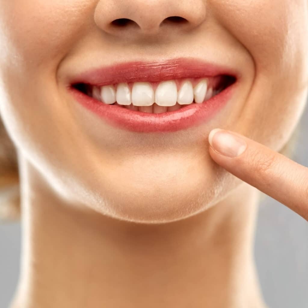 teeth whitening in leicester best dentist in leicester