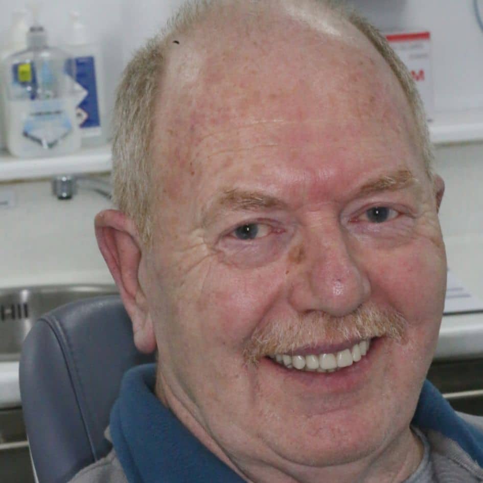 patient face picture after implant treatment in dentist leicester